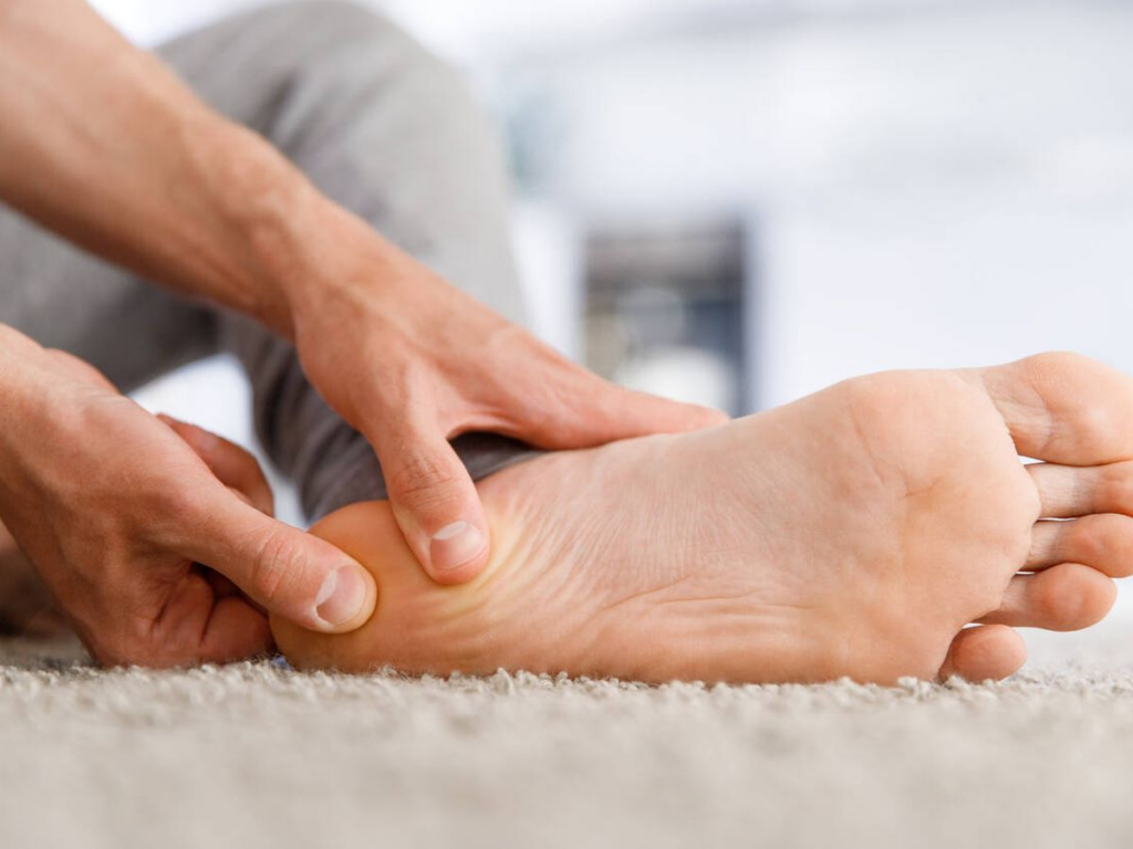 minusvalía fascitis plantar